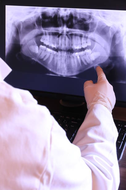 Best Emergency Root Canal Treatment in Crosby, ND