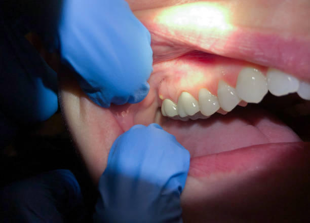 Best 24-Hour Emergency Dentist in Crosby, ND
